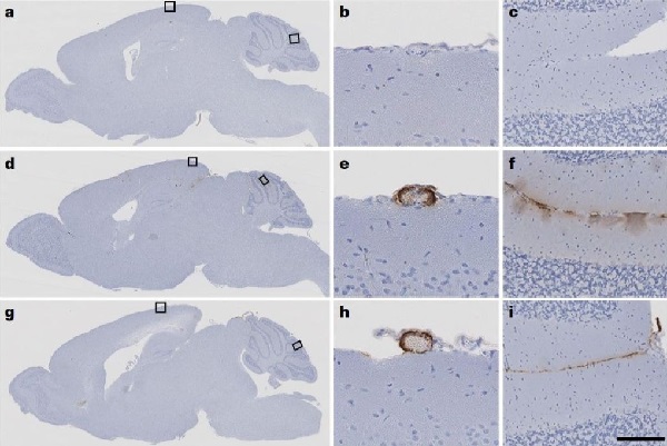 Amyloid Pathology Transmission In Lab Mice And Historic Medical Treatments 