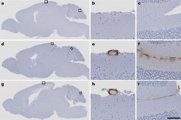 Transmisión de patología amiloidea en ratones de laboratorio y tratamientos médicos históricos